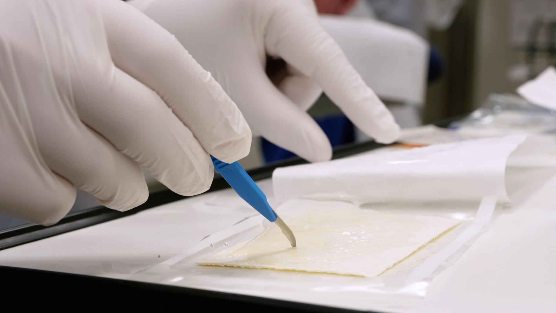 Kompartmentsyndrom: Ursachen, Symptome und Behandlung