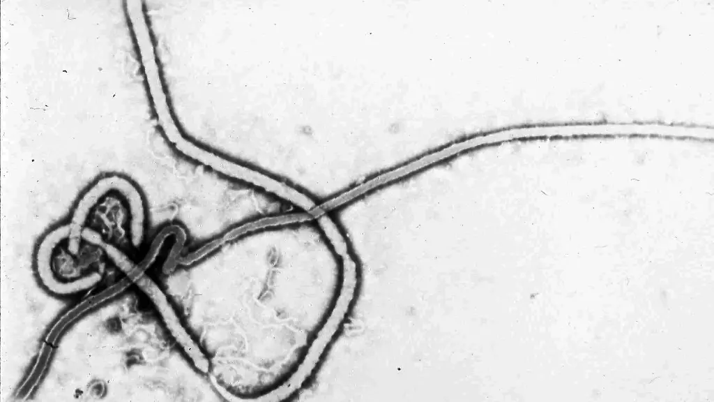 Was man über das Ebolavirus wissen muss