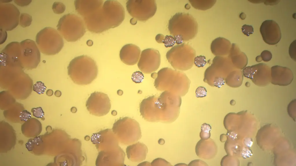 Harmloser Keim wird zur Gefahr: Forscher enthüllen Mechanismus extremer Antibiotika-Resistenzen