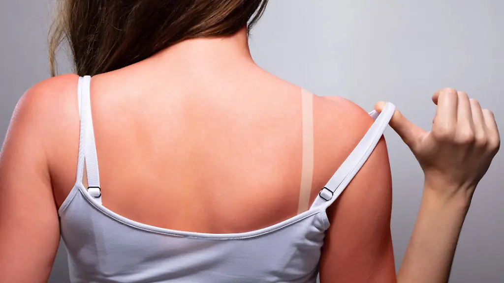 Gefahren des Trends „Tanmaxxing“ für die Haut