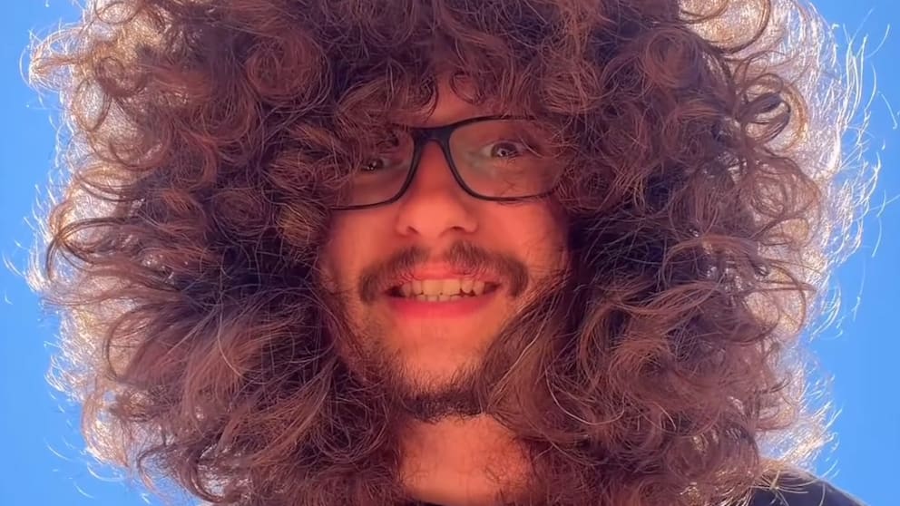 Der britische Influencer und sein beeindruckendes Haarwachstum