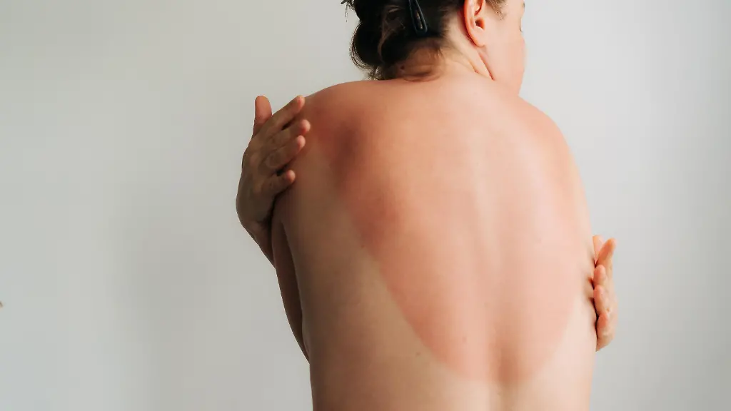 Krebsrisiko durch UV-Strahlung