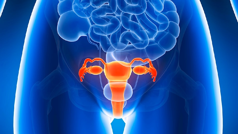 Gynäkologin erklärt Endometriose und ihre Herausforderungen