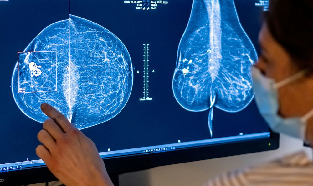 Das Recht auf Vergessen: Eine Diskussion über Krebsdiagnosen und ihre rechtlichen Folgen
